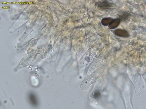 Coprinopsis pseudogracilis - Cheilozystiden - 
