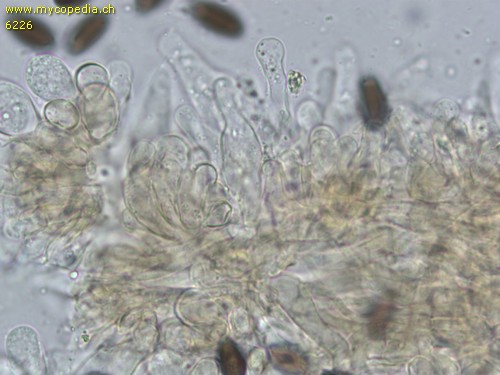 Psathyrella microrhiza - Cheilozystiden - 