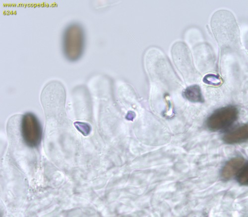 Psathyrella microrhiza - Cheilozystiden - 