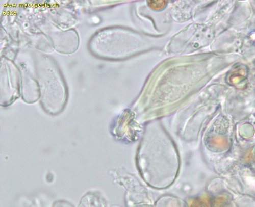 Inocybe appendiculata - Cheilozystiden - 