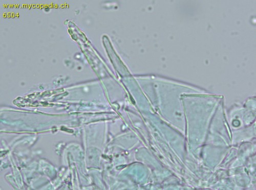 Melanoleuca grammopodia - Kaulozystiden - 