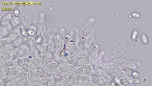 Lepiota felina - Cheilozystiden - 