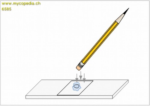 Quetschprparate - 