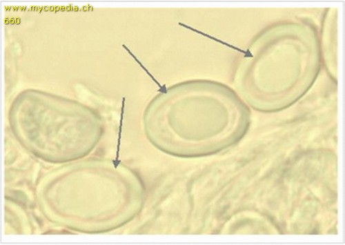 Metachromasie - 