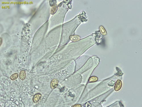 Inocybe nitidiuscula - Cheilozystiden - 