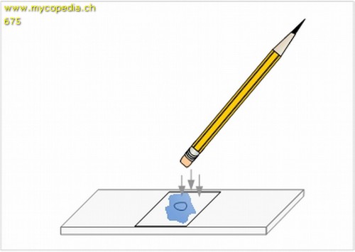 Metachromasie - 