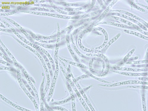 Spathularia flavida - Sporen - 