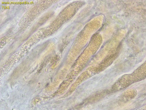 Peniophora incarnata - Gloeozystiden - 