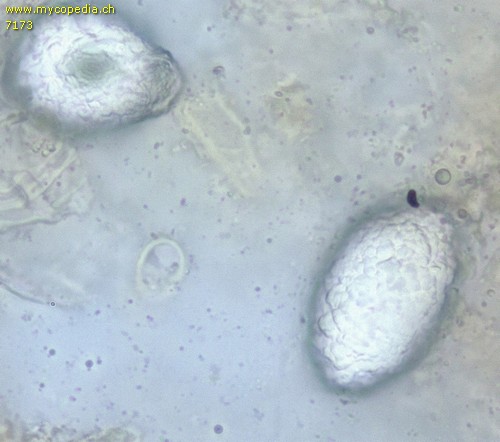 Peniophora lycii - Lamprozystiden - 