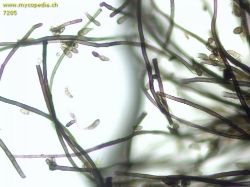 Helminthosporium quercinum - Sporen - 