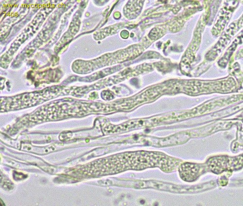 Cylindrobasidium evolvens - Lepotozystide - 