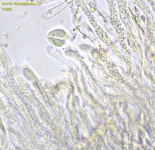 Cylindrobasidium evolvens - Lepotozystide - 