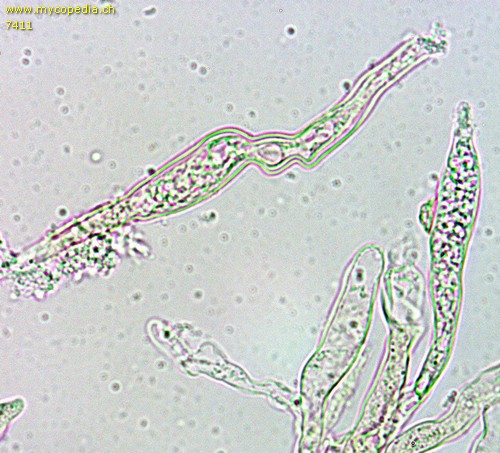 Cylindrobasidium evolvens - Lepotozystide - 