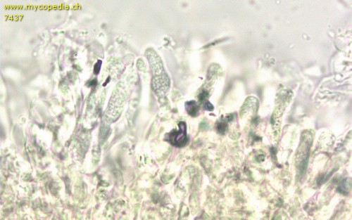 Hyphodontia abieticola - Basidien - Wasser  - 