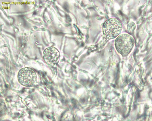 Tremella globispora - Hypobasidien - 