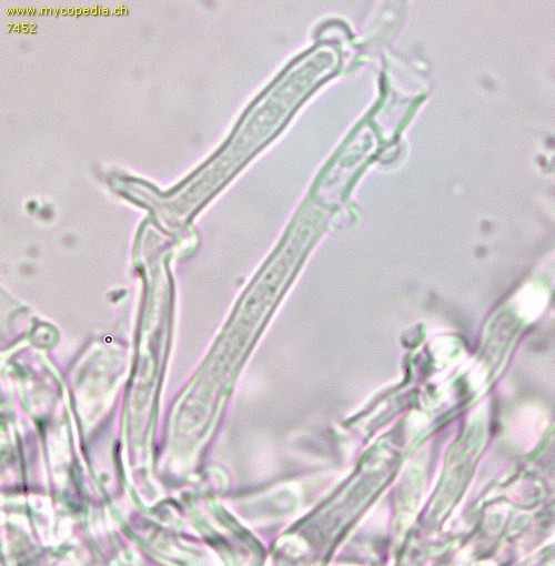 Kneiffiella abieticola - Hyphen mit Schnallen - 