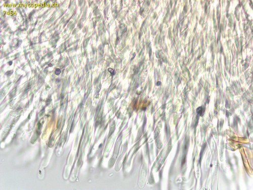 Kneiffiella abieticola - Hyphenenden der Kortikalschicht - 