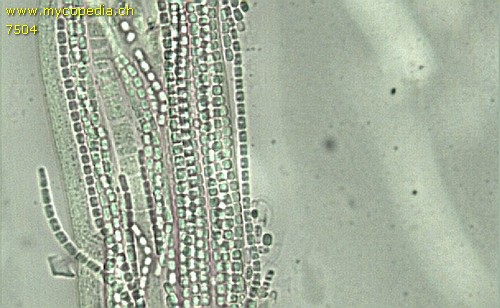 Ophiocordyceps sinensis - Asci - 