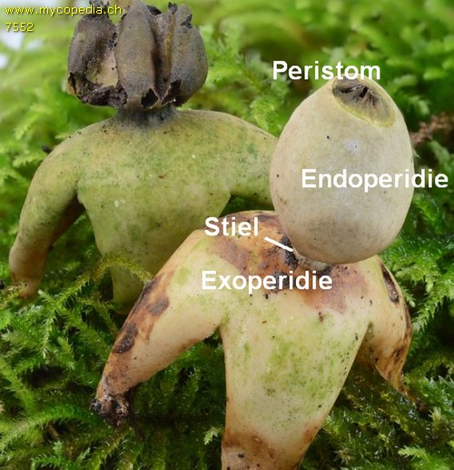 Endoperidie - 