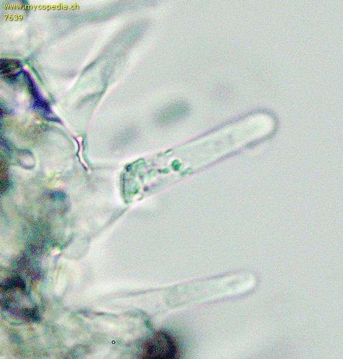 Panaeolus fimicola - Cheilozystiden - 