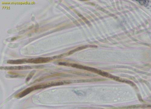 Lanzia echinophila - Paraphysen - KOH  - 