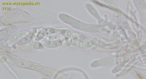 Sclerotinia echinophila - Asci - KOH  - 