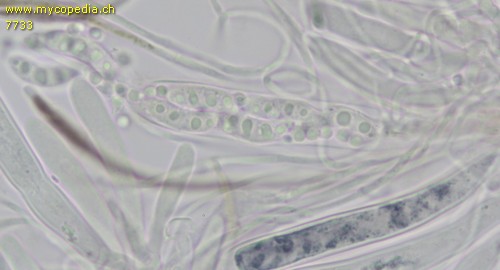 Lanzia echinophila - Asci - KOH  - 