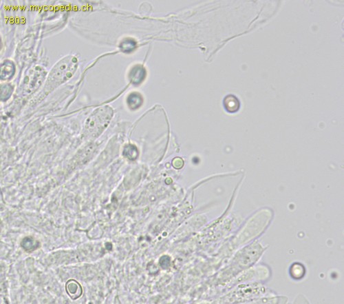 Pluteus ephebeus - Cheilozystiden - 