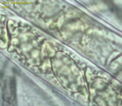 Melastiza cornubiensis - Spore/n - 