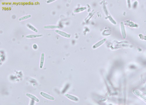 Trichopezizella nidulus - Sporen - 