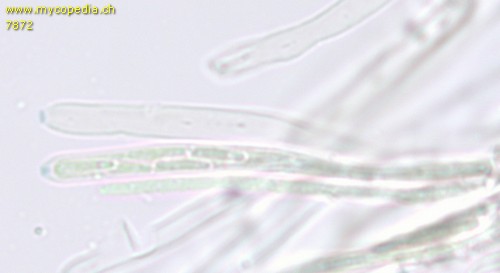 Trichopezizella nidulus - Asci - Melzers  - 