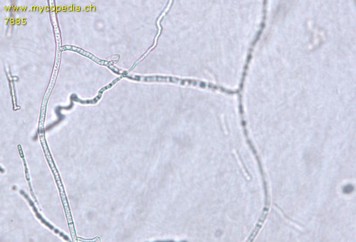 Cyanobakterien Nostoc - Hyphen - 