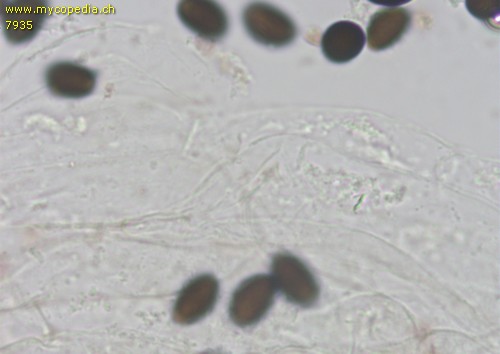 Coprinopsis cinerea - HDS Velum - 