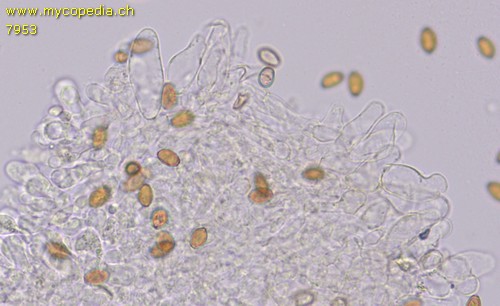 Pholiotina utricystidiata - Cheilozystiden - 