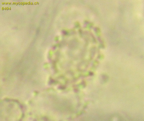 Tricholomella constricta - Sporen - Melzers  - 