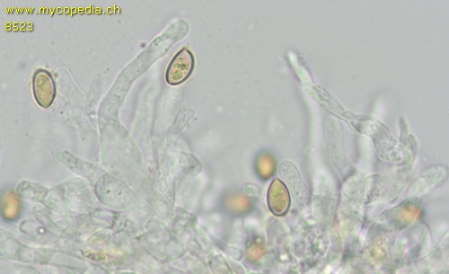 Pholiotina arrhenii - Cheilozystiden - 