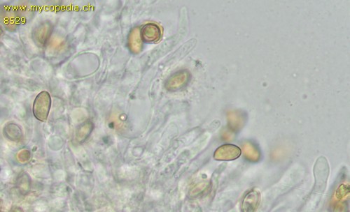 Pholiotina arrhenii - Cheilozystiden - 