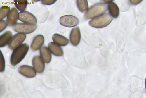 Coprinellus truncorum - Pleurozystiden - 