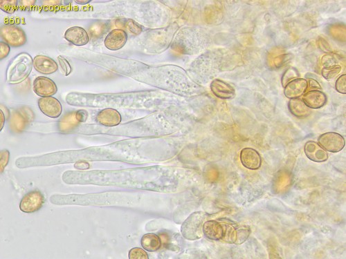 Galerina vittiformis - Cheilozystiden - 