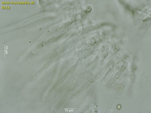 Trichoderma gelatinosum - Asci - 