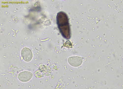Lachnella alboviolascens - Sporen - 