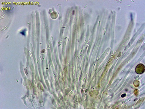 Mollisia cinerea - Paraphysen - 