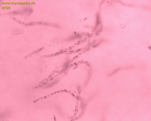 Russula claroflava - Primoridalhyphen inkrustiert - 