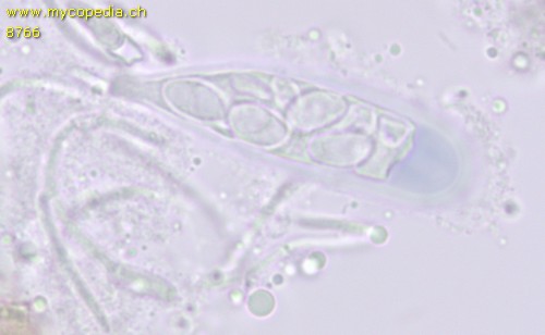 Lecidella elacochroma - Asci - 