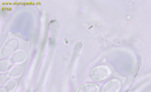 Lecidella elacochroma - Asci - 