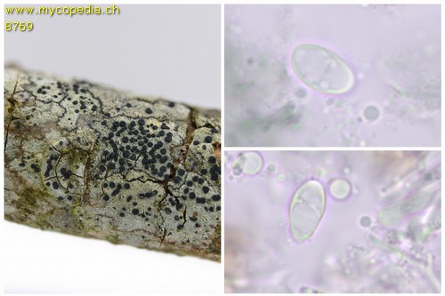 Lecidella elacochroma - Sporen - 