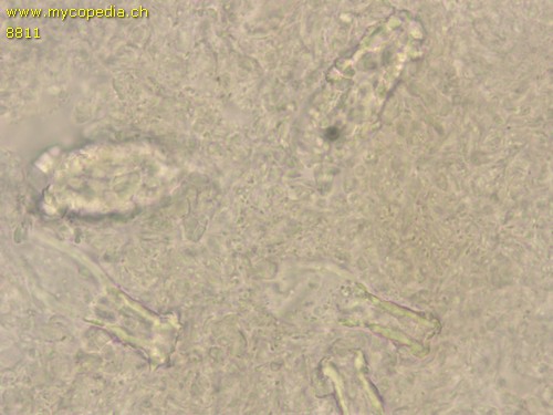 Strobilurus esculentus - Pleurozystiden - 