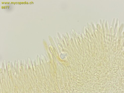 Dasyscyphella nivea - Asci - 