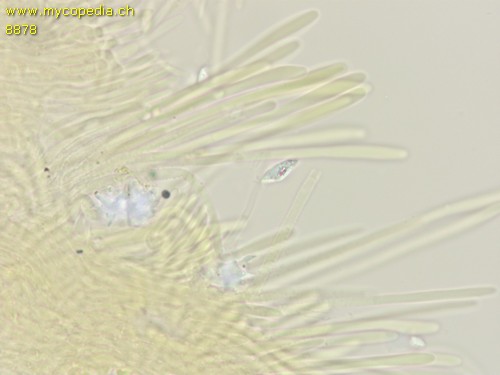 Dasyscyphella nivea - Randhaare - Melzers  - 