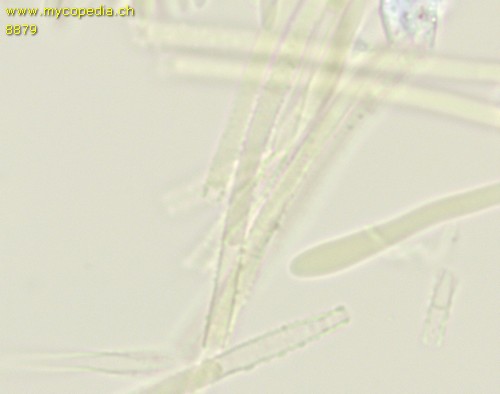 Dasyscyphella nivea - Haare - Melzers  - 